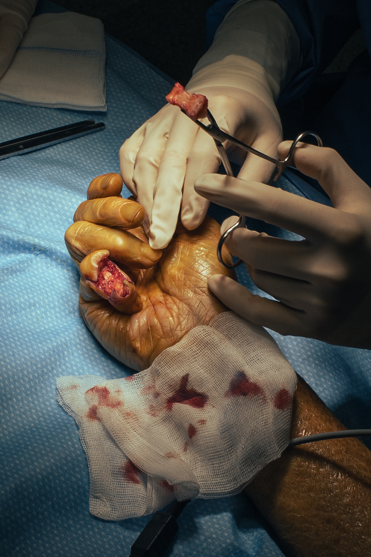 3 months in an orthopedic surgery room